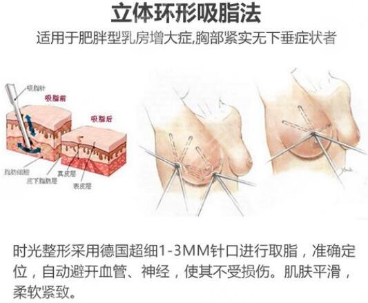 缩胸