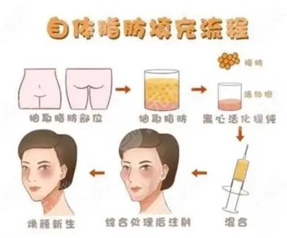 上海九院整形科擅长项目