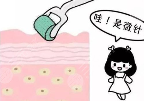 美莱黄金微针多少钱做一次?