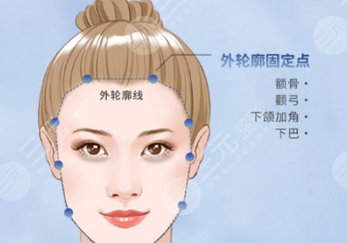 轮廓整形一般需要多少钱？