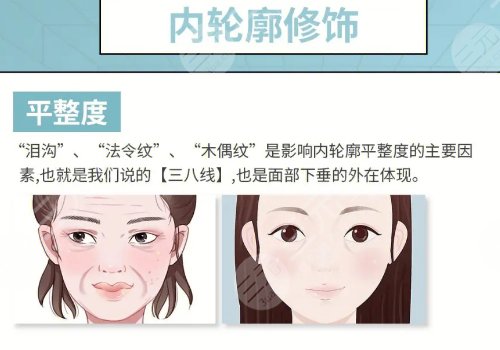 轮廓整形一般需要多少钱？