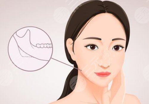 轮廓整形一般需要多少钱？