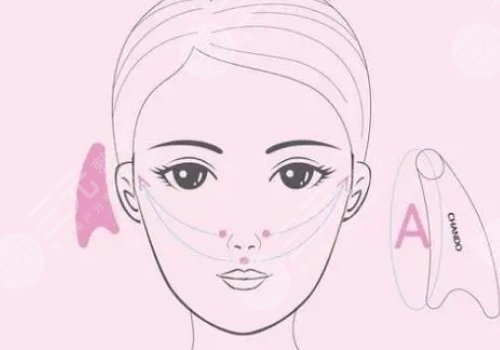 轮廓整形一般需要多少钱？