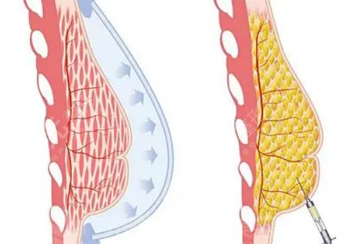 上海华山医院整形科医生介绍
