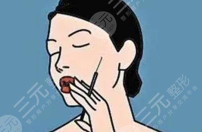 丰下巴