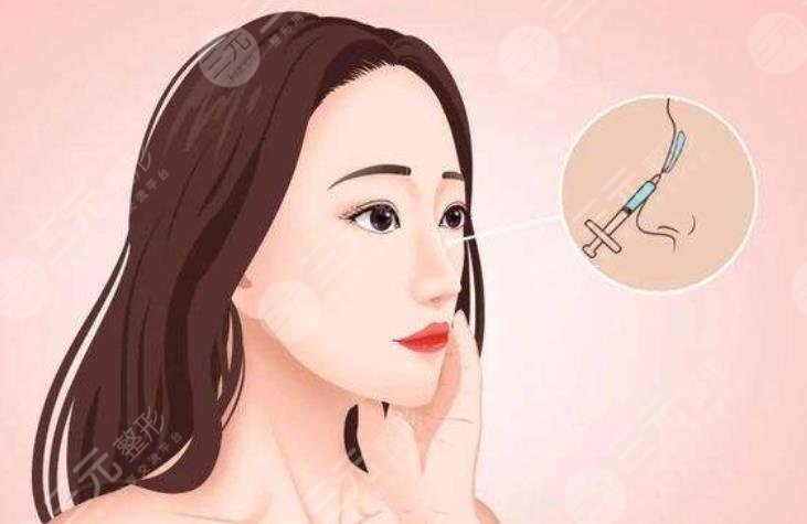 打玻尿酸隆鼻的价格是多少