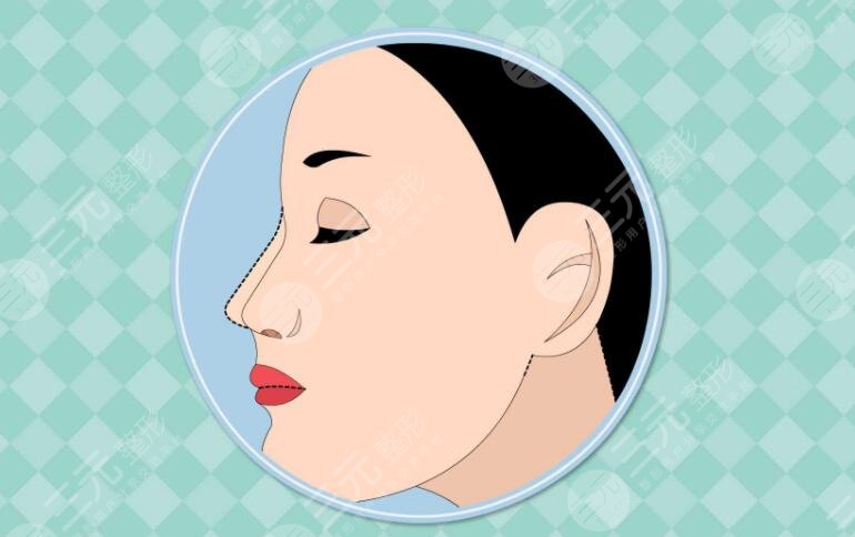 任东医生做鼻子价格