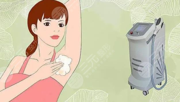 面部激光脱毛
