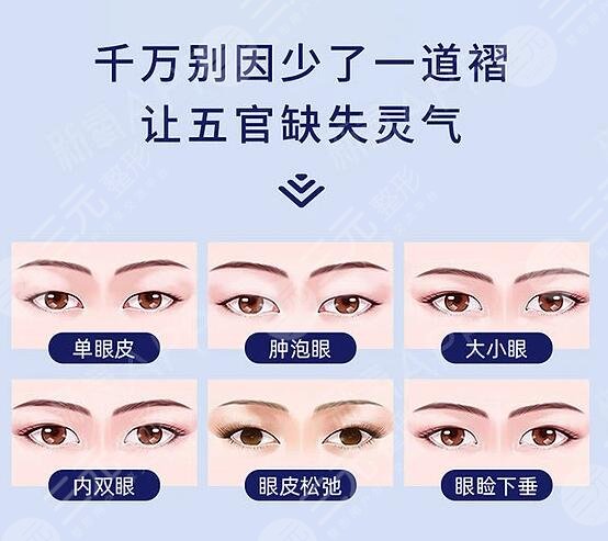 影响割双眼皮价格的因素