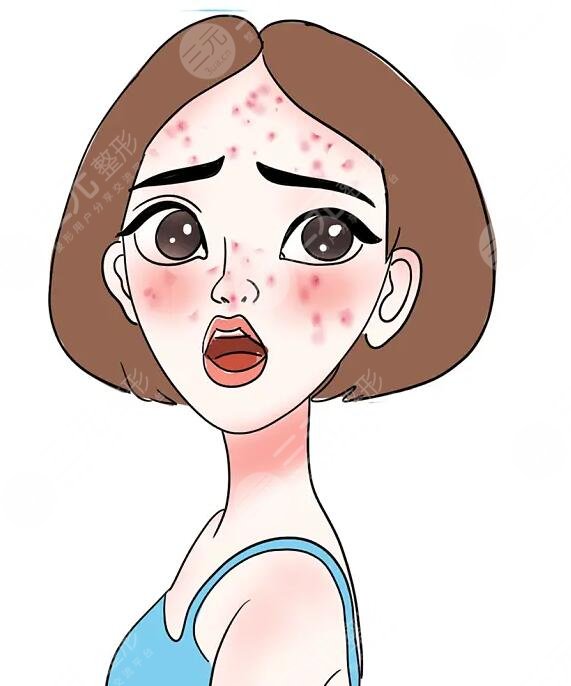 价格影响因素大汇总,科学合理的对抗痘痘~-城市惠整形