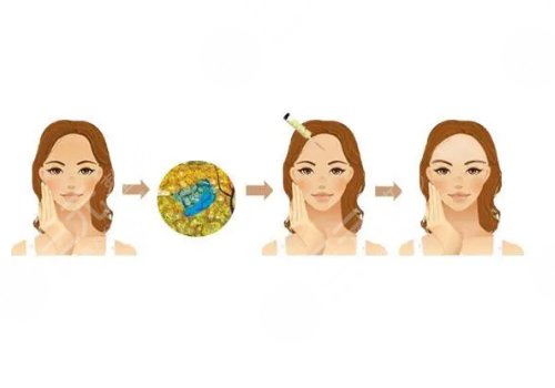 八大处韩雪峰价位全新一览