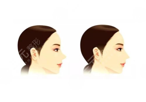 北京大学深圳医院隆鼻坐诊医生介绍