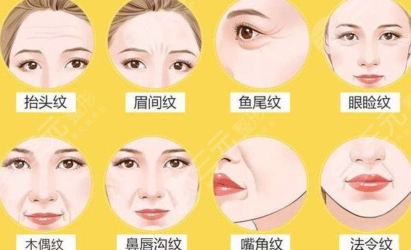 除皱