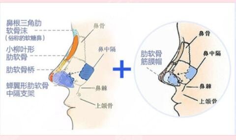 鼻子整形手术