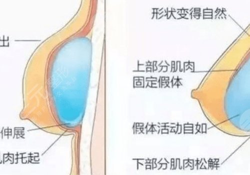 重庆华美做鼻子怎么样?