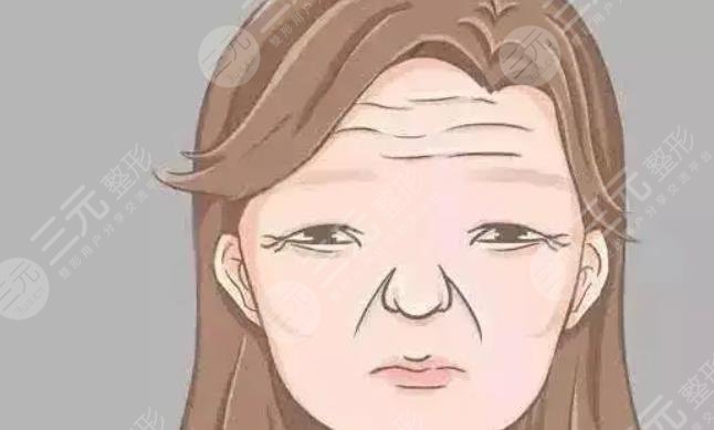 抬头纹