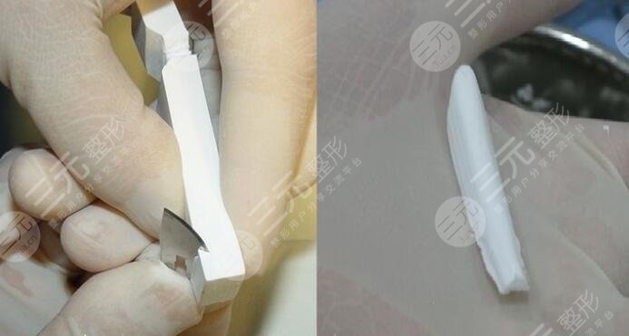 膨体材料隆鼻多少钱?