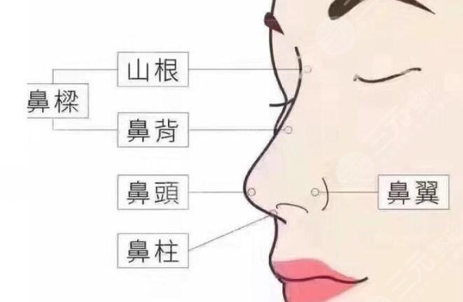 膨体隆鼻有什么优缺点?