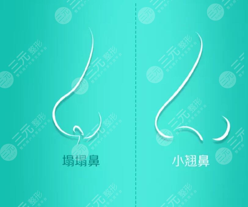 膨体隆鼻注意什么?