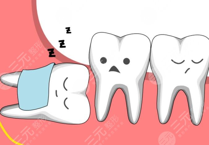 拔智齿的注意事项