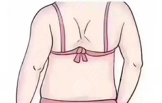 背部吸脂多少钱一次?