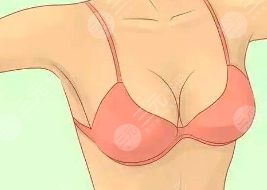 自体脂肪隆乳