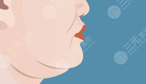 双下巴吸脂多少钱2025年？价位影响因素逐一爆出，帮你保持你的年少感！