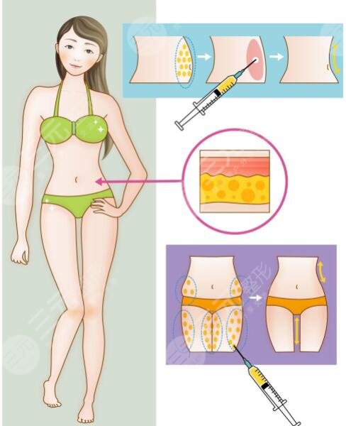 腹部抽血之后要做护理吗?