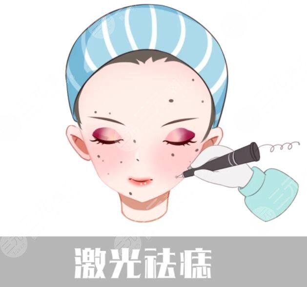 激光祛痣