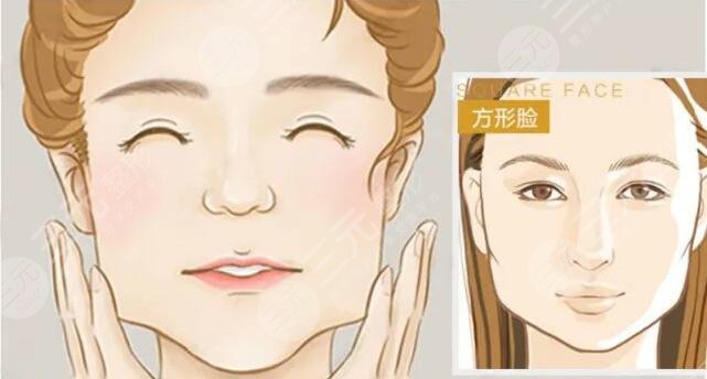 超声法瘦脸手术