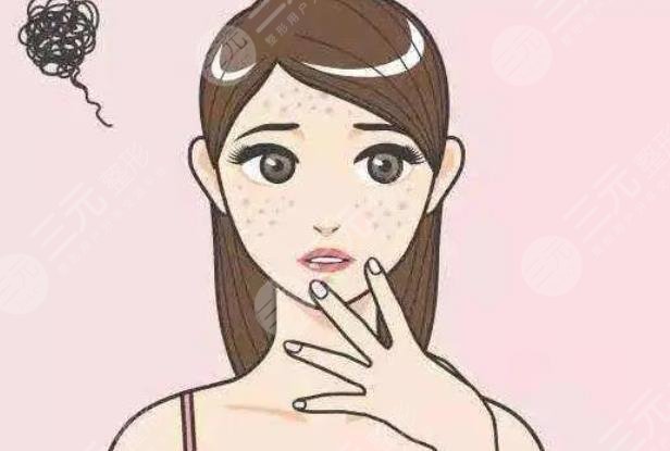 斑点