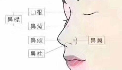 隆鼻整形