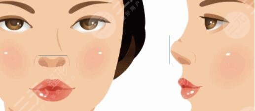 天津医科大学第二医院医疗整形美容科热门项目