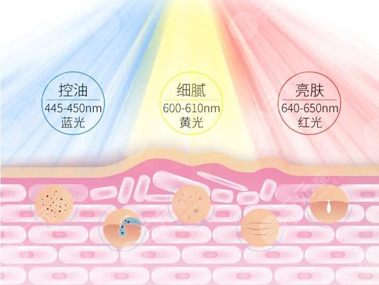 做光子嫩肤价格影响因素