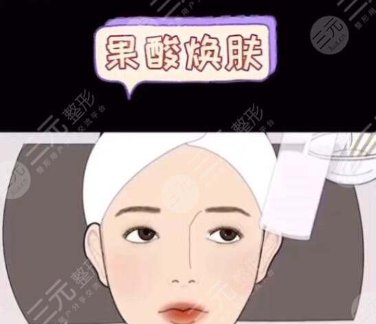 果酸多少钱一次正常情况？果酸换肤的注意事项有哪些？医美小白必看此篇~