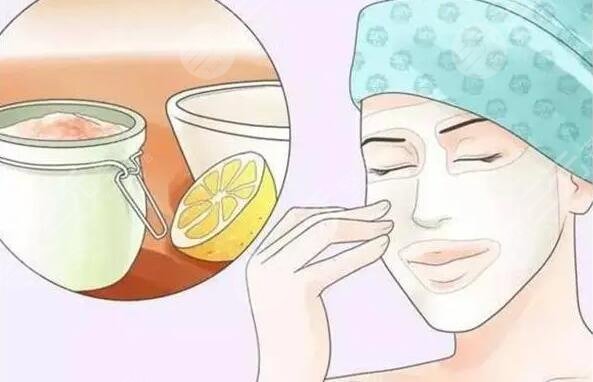 果酸多少钱一次正常情况?