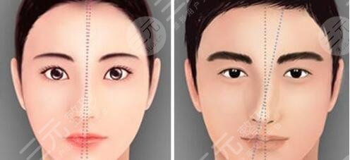 歪鼻矫正手术怎样操作?