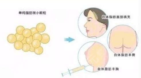 自体