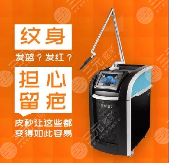 洗纹身