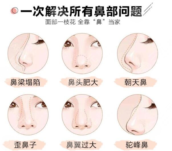 鼻部整形