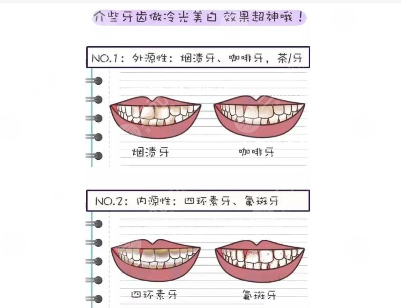 深圳人民医院牙齿矫正大概?多少钱?口腔科介绍