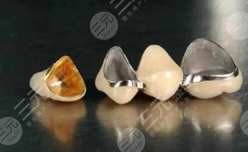 半贵金属烤瓷牙价格的影响因素: