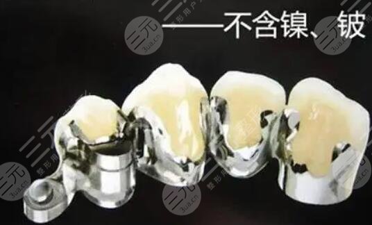 不同的医院在做这项手术时的费用也会有所差异