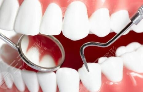 不同的医院在做这项手术时的费用也会有所差异