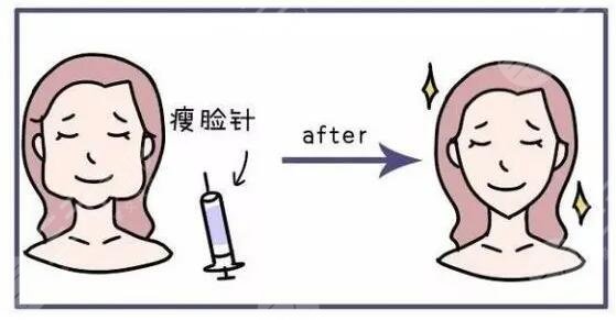 南京市第一医院整形科瘦脸价格多少钱?