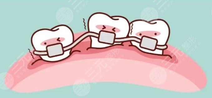 清远人民医院口腔科牙齿正畸案例