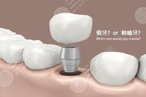 清远人民医院口腔科热门项目：