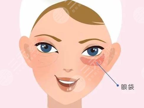 超声法去眼袋多少钱