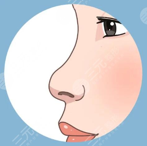 假体隆鼻