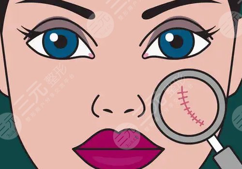 脸部伤疤整形要多少钱费用报价,疤痕修复的方式都有哪些?你适合哪种?